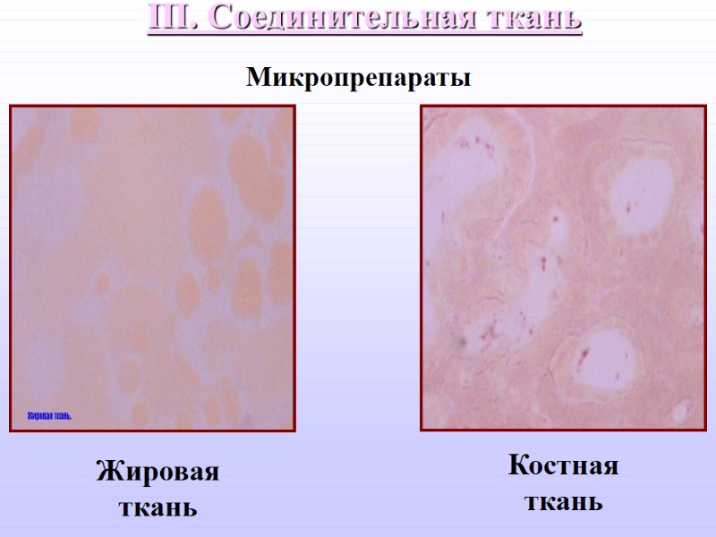 III. Соединительная ткань  Жировая ткань Костная ткань Микропрепараты